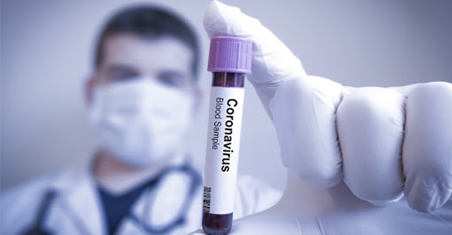 Seguro de vida coronavírus cobre morte? Entenda 